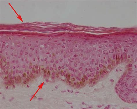 Tecido Epitelial Estratificado Pavimentoso Queratinizado - REVOEDUCA