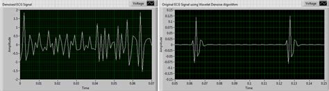 Snap shots of denoised ECG signal after using WA Detrend algorithm and... | Download Scientific ...