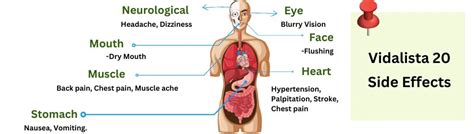 Vidalista 20 Side Effects: What You Need to Know