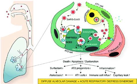 Severe hypoxemia probably occurs during the phase whereby a relative ...