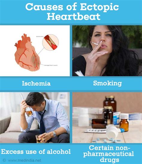 Ectopic Heartbeat - Causes, Symptoms, Diagnosis, Treatment, Complications