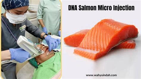 DNA Salmon di ZAP Clinic Malang