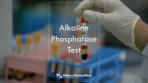 Alkaline Phosphatase Test Low, Normal Range, High Meaning - Medical ...