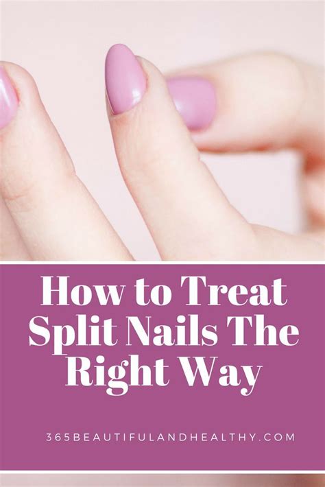 How to Treat Split Nails The Right Way | Split nails, Nail care tips, Nails