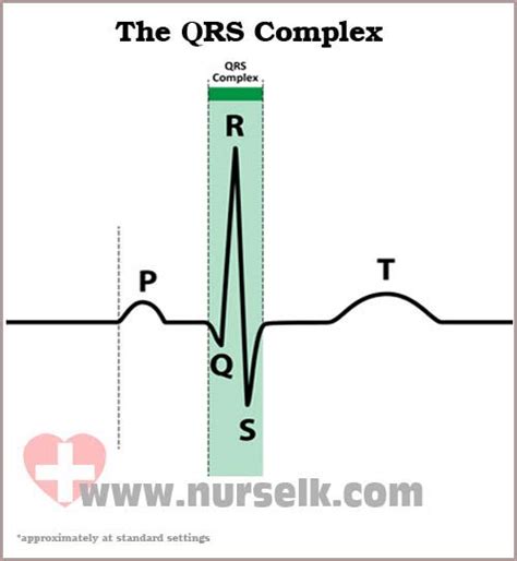 How to read an Electrocardiogram (ECG) - Part 5, The QRS Complex | Nurselk.com