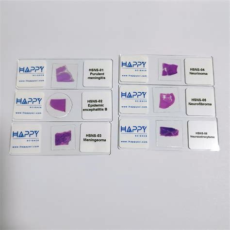 6pcs Human Pathology Slides of Nervous System, Factory Outlets