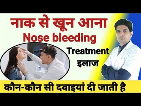 Nose bleeding treatment | Nasal bleeding treatment - YouTube