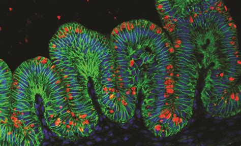 Good Bacteria in Stomach May Aid in Weight Loss, Study Says | Science Times