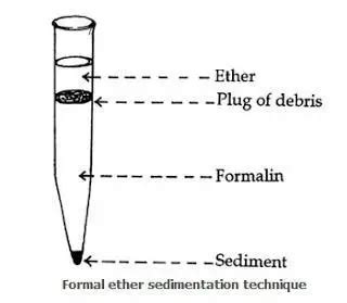 Formal Ether Sedimentation Technique • Microbe Online