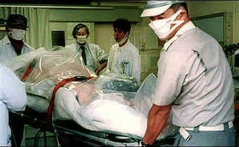 Hisashi Ouchi One Of The Worst Radiation Incident R Eyeblech – Otosection