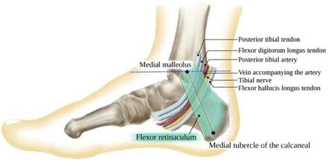 Tarsal Tunnel Syndrome - WikiMSK