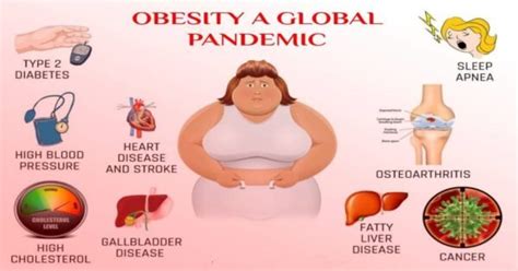 Obesity: Causes, Side effects, Facts and Prevention | Arriba Trends