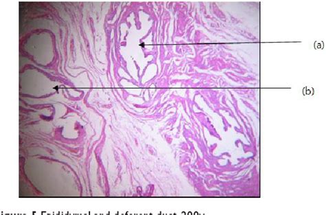 Figure 5 from A case of labioscrotal ovotestis in Madagascar with ...