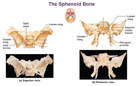 sphenoid bone superior and posterior views greater lesser wings sella ...