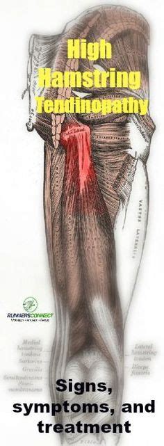 In Case You Missed: Hamstring Tendinopathy Injuries