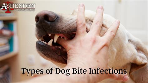 Types of Dog Bite Infections | Ashenden & Associates