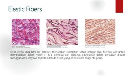 Jaringan ikat ( CONNECTIVE TISSUE)