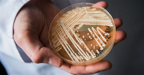 Deadly fungal infection spreading at an alarming rate, CDC says