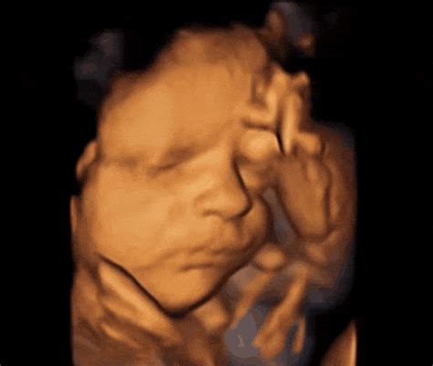 A Week by Week Guide through Fetal Development | Afflictions eclipsed by glory 3d Ultrasound ...