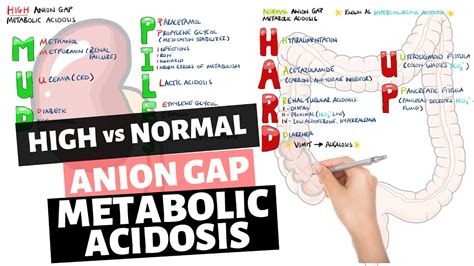 Metabolic Acidosis Causes Mnemonic