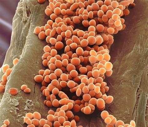 Lactococcus lactis bacteria, SEM - Stock Image - C020/7526 - Science Photo Library