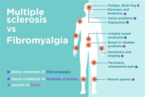 Multiple Joint Pain Without Swelling : 7 What Causes Arthritis Ideas ...