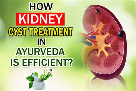 Karma Aayurveda: Ayurvedic Kidney Cyst Treatment - Dr. Puneet Dhawan