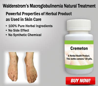 Natural Remedies for Waldenstrom's Macroglobulinemia Symptoms and Causes | Blog | StoryMirror