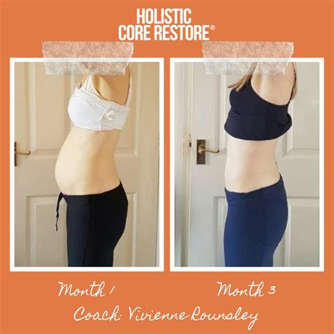 Before & After Diastasis Recti Repair Gallery - Holistic Core Restore