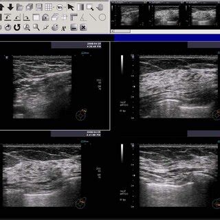 Portable ultrasound machine equipped with PACS device. The PACS device ...