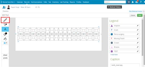 All About Dental Charting – Practo Help