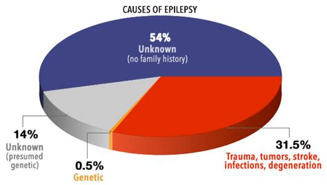 Causes of Epilepsy: What Causes Epilepsy? - Health Normal