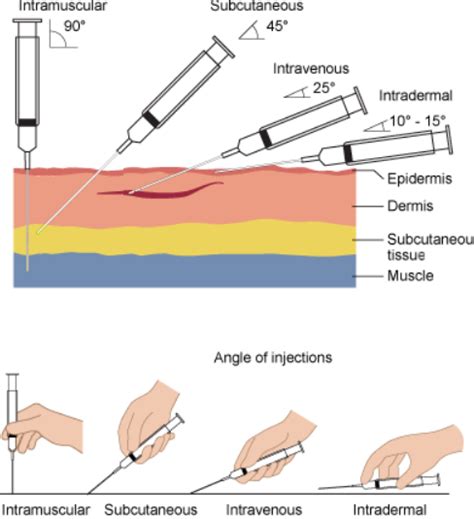 Injection | Encyclopedia MDPI