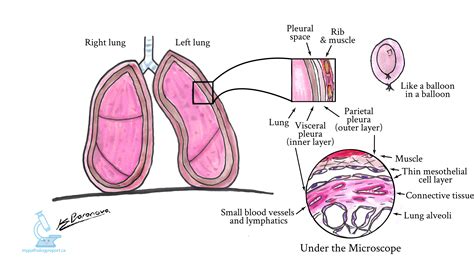 Mesothelioma - MyPathologyReport.ca