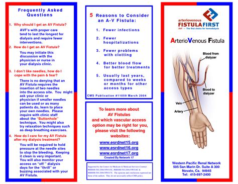 Arteriovenous Fistula Types Symptoms Diagnosis Causes And Treatment | The Best Porn Website