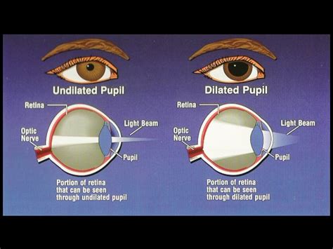 Mydriasis - Causes, Symptoms And Treatment