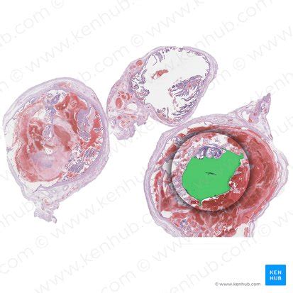 Amniotic sac: Anatomy, structure and function | Kenhub