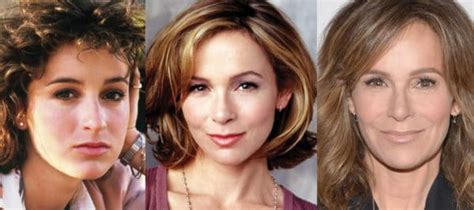 Jennifer Grey Plastic Surgery Before and After Pictures 2024