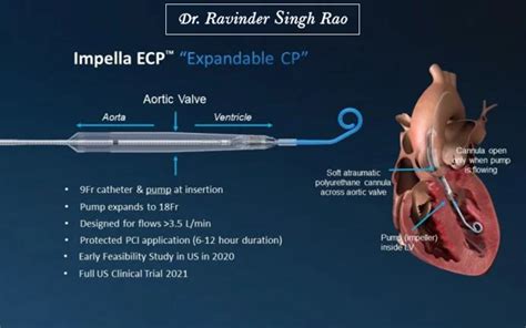 What is an Impella Heart Pump: How it Works, Risk, Benefits & Procedure