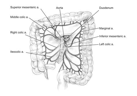 Ileocolic Artery - Stepwards