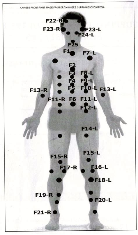 The 64 best hijama points images on Pinterest | Acupuncture, Cupping therapy and Massage therapy