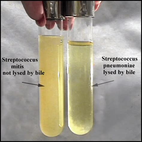 Bile Solubility Test: Principle, Procedure, Results • Microbe Online