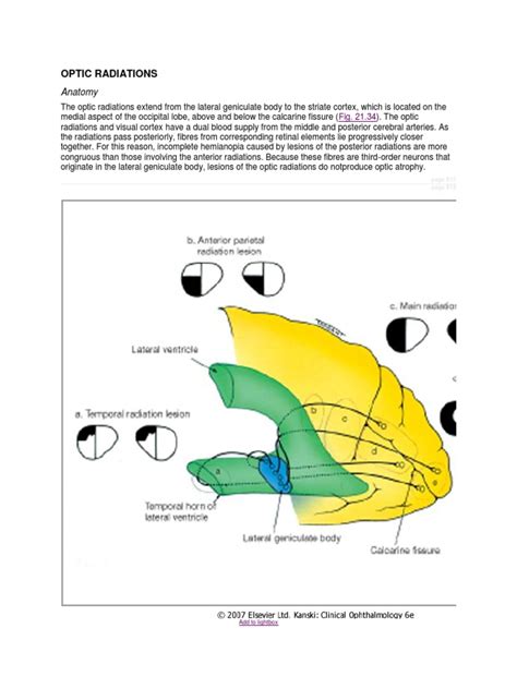 Optic Radiations: Anatomy