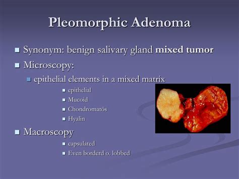 Ppt Malignant Salivary Gland Tumors Powerpoint Presentation Id | SexiezPicz Web Porn