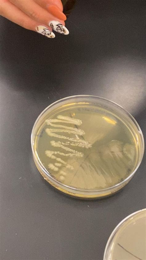 Microbiology experiment | Science experiments, Microbiology, Biology