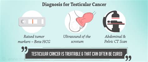 Testicular Cancer How Is It Diagnosed - CancerWalls