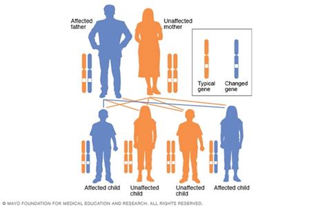 Neurofibromatosis type 1 - Symptoms and causes - Mayo Clinic