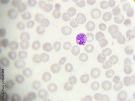 Malaria parasite (gametocyte stage) in peripheral blood smear Stock Photo | Adobe Stock