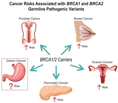 Cancers | Free Full-Text | Gastric Cancer Risk and Pathogenesis in ...