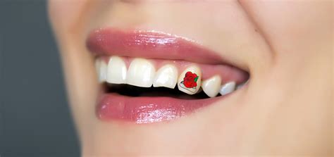 Strange Tooth Modifications - Teeth Tattoos - Summerlea Dental